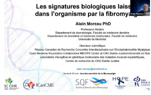 Les signatures biologiques laissées dans l’organisme par la fibromyalgie